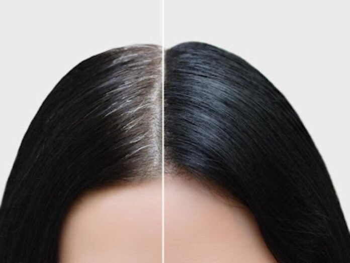 Dandruff Home Remedy: Coconut Oil and Lemon for a Healthy Scalp